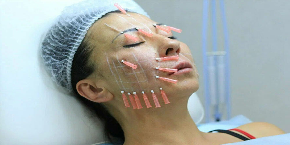  لاغری به روش مزو امبدینگ